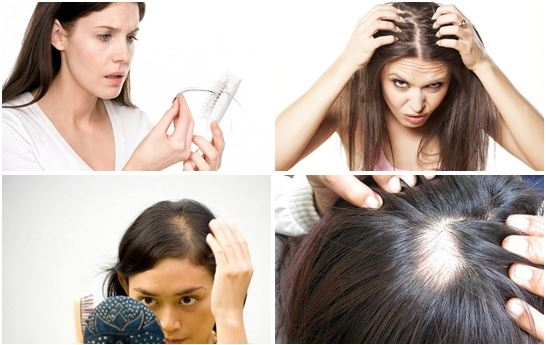 causes-of-lack-of-hair